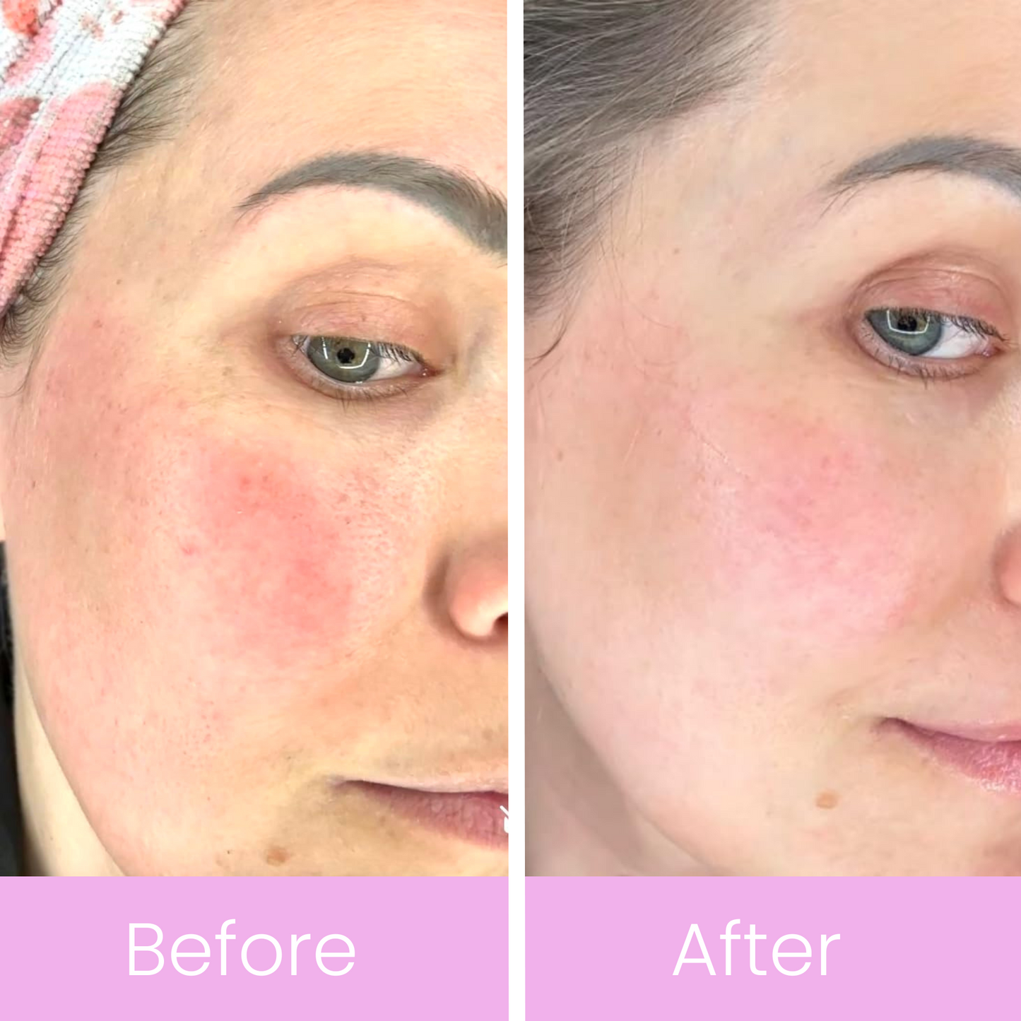 Radiant Renewal Overnight Mask™