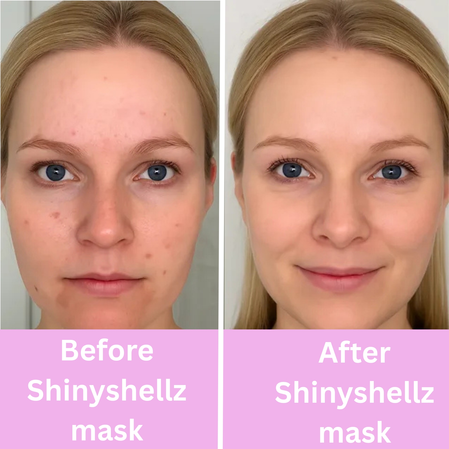 Radiant Renewal Overnight Mask™