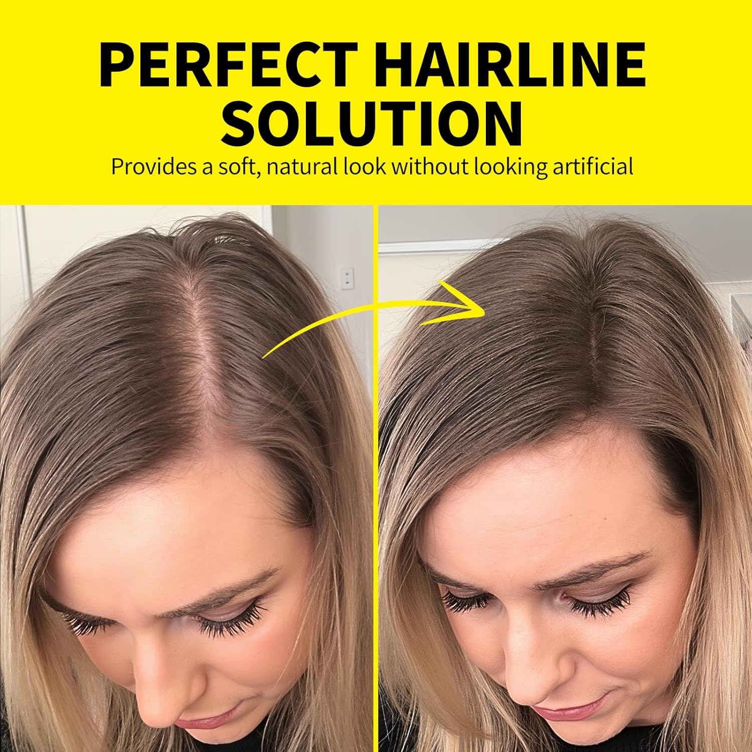 FOLIX™ Instant HairFill