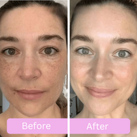 Radiant Renewal Overnight Mask™